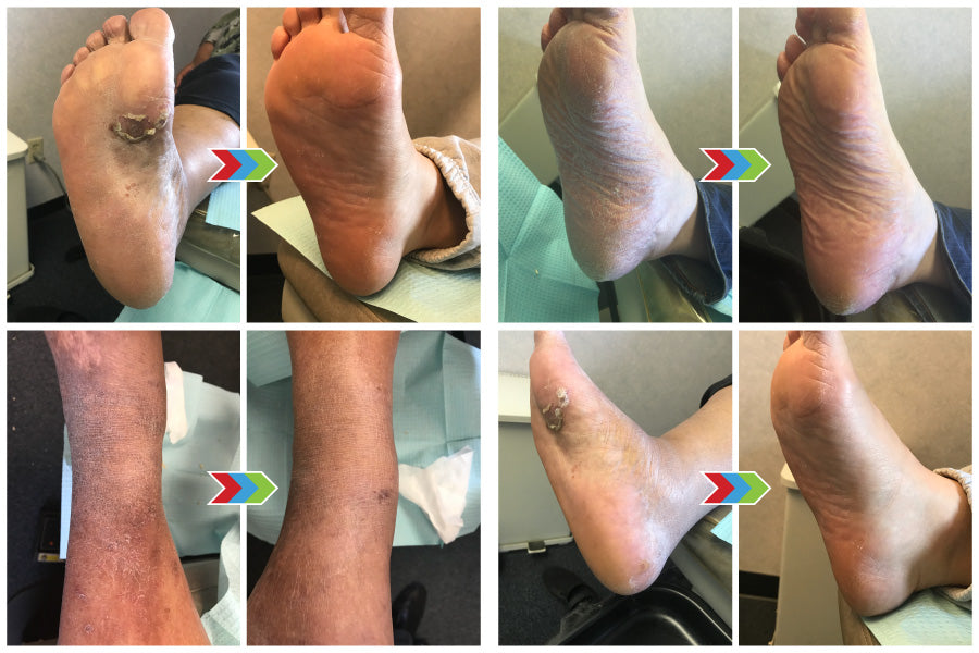 Customers show their amazing results from using Diabetes Support Wipes.