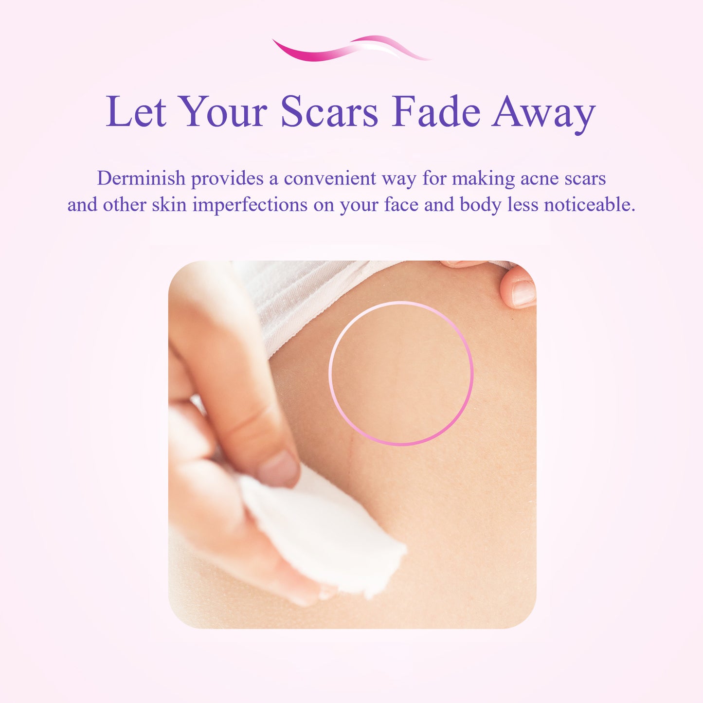 Let your scars fade away. Derminish provides a convenient way for making acne scars and other skin imperfections on your face and body less noticeable.