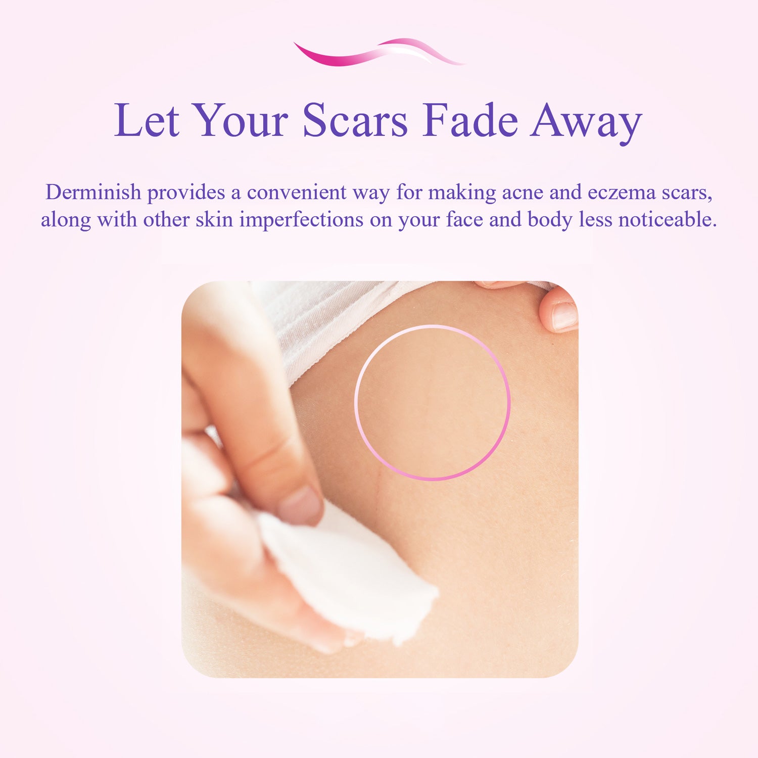Let your scars fade away. Derminish provides a convenient way for making acne and eczema scars, along with other skin imperfections on your face and body less noticeable.