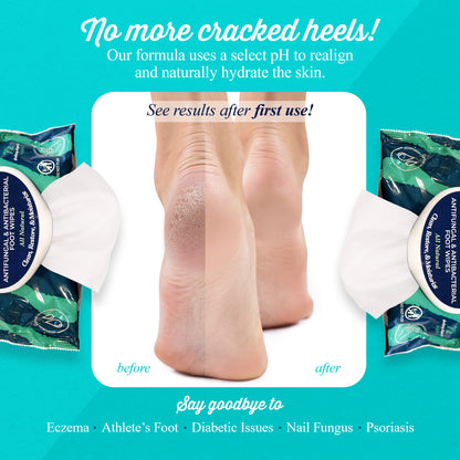 No more cracked heels! Our formula uses a select pH to realign and naturally hydrate the skin. See results after first use! Say goodbye to eczema. althlete's foot, diabetic issues, nail fungus and psoriasis.
