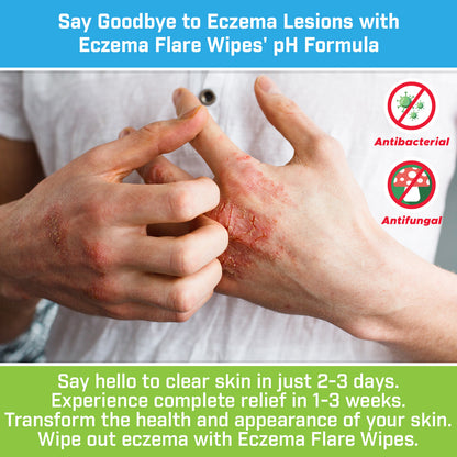 Say Goodbye to Eczema Lesions with Eczema Flare Wipes' pH Formula. Say hello to clear skin in just 2-3 days. Experience complete relief in 1-3 weeks. Transform the health and appearance of your skin. Wipe out eczema with Eczema Flare Wipes.