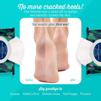 No more cracked heels! Our formula uses a select pH to realign and naturally hydrate the skin. See results after first use! Say goodbye to eczema. athlete's foot, diabetic issues, nail fungus and psoriasis.