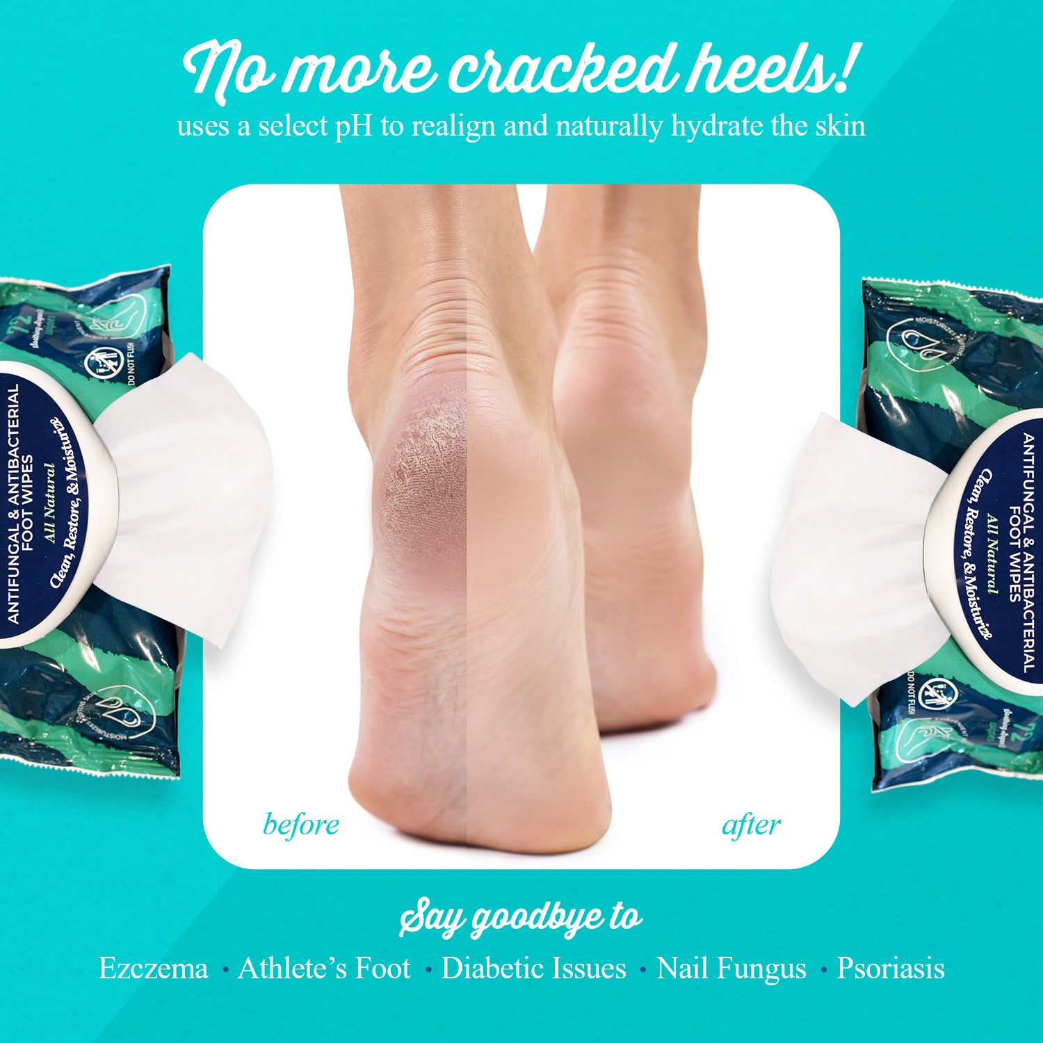 No more cracked heels! Our formula uses a select pH to realign and naturally hydrate the skin. See results after first use! Say goodbye to eczema. althlete's foot, diabetic issues, nail fungus and psoriasis.