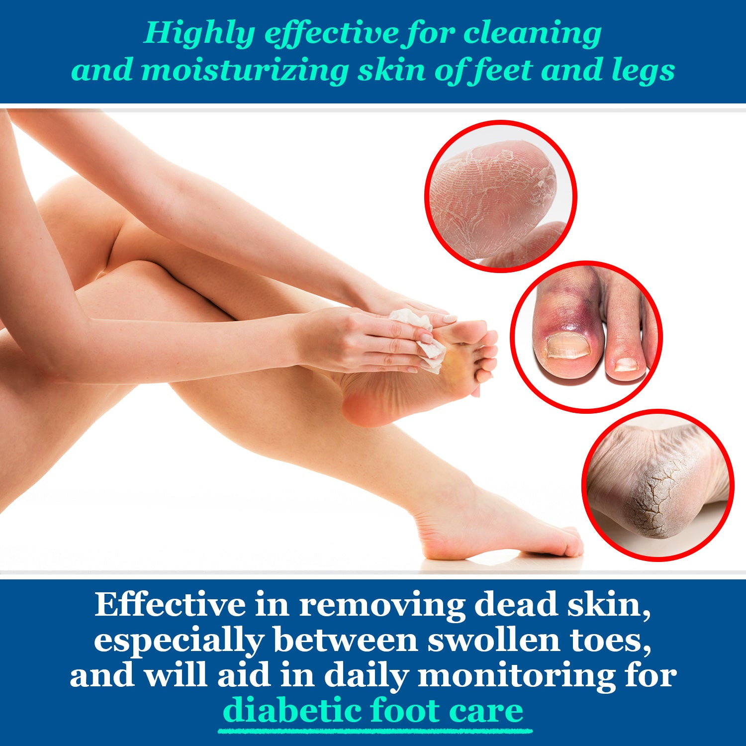 Highly effective for cleaning and moisturizing skin of feet and legs. Effective in removing dead skin, especially between swollen toes, and will aid in daily monitoring for diabetic foot care.